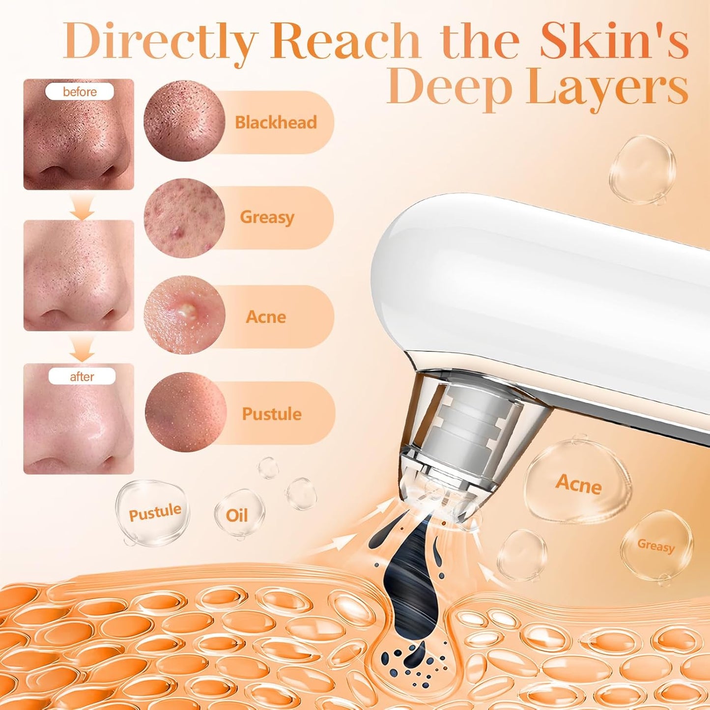 Aspirateur Points Noirs Éclat Visage™